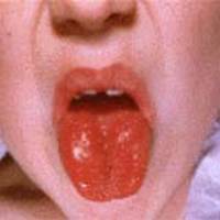 �������� KAWASAKI (5).jpg